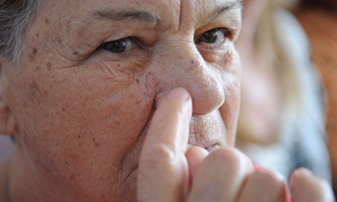 Dezembro Laranja: Brasileiros devem redobrar cuidados no verão contra câncer de pele