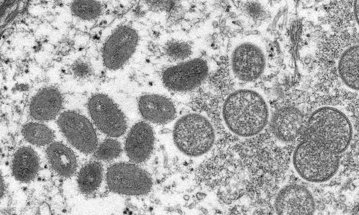 Aparecida registra dois casos de varíola dos macacos